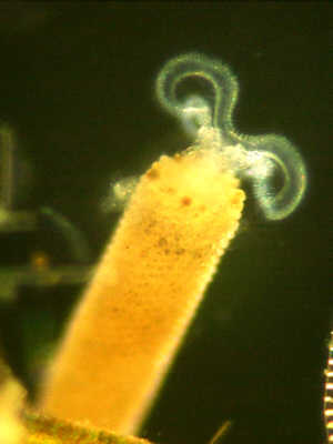 Floscularia sp.