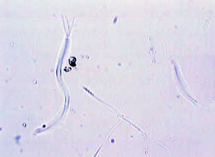 sperms of Cipangopaludina