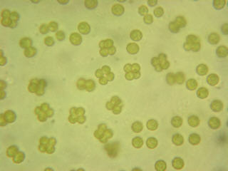 cells of Tetraspora