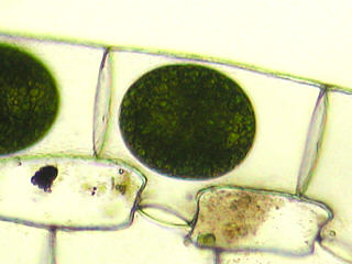 Zygotes of Spirogyra (close up)
