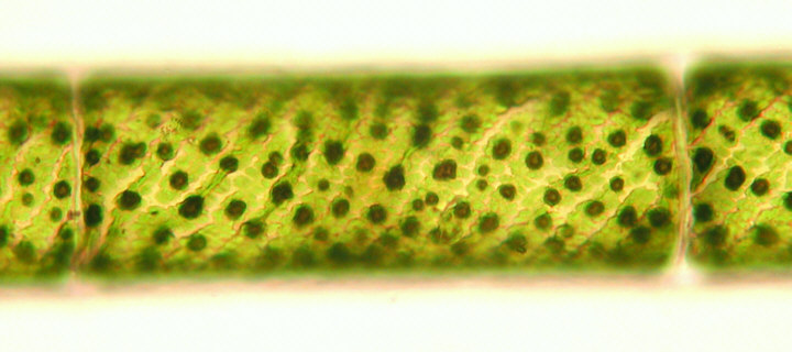 Pyrenoids in Spirogyra